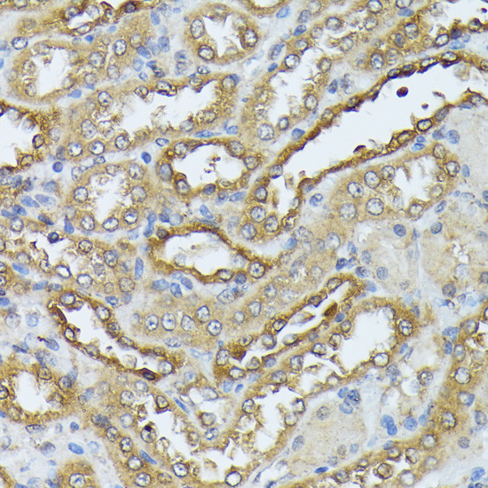 ZIPK Antibody in Immunohistochemistry (Paraffin) (IHC (P))