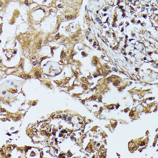 ZIPK Antibody in Immunohistochemistry (Paraffin) (IHC (P))