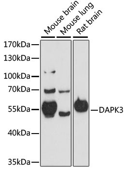 ZIPK Antibody in Western Blot (WB)