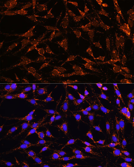 XK Antibody in Immunocytochemistry (ICC/IF)