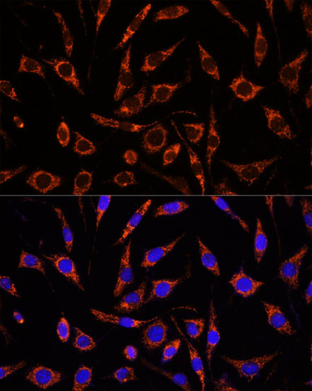 XK Antibody in Immunocytochemistry (ICC/IF)