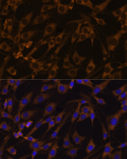 eIF5B Antibody in Immunocytochemistry (ICC/IF)