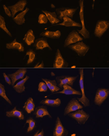 eIF5B Antibody in Immunocytochemistry (ICC/IF)