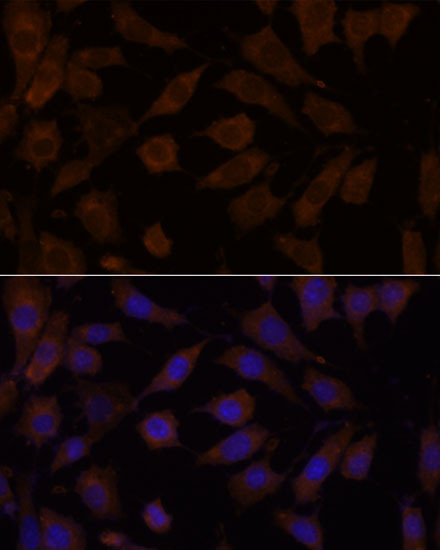 OXSR1 Antibody in Immunocytochemistry (ICC/IF)