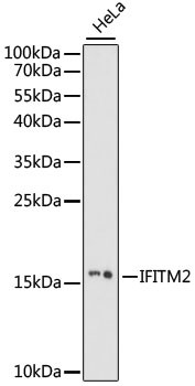 IFITM2 Antibody in Western Blot (WB)