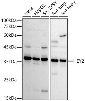 HEY2 Antibody in Western Blot (WB)