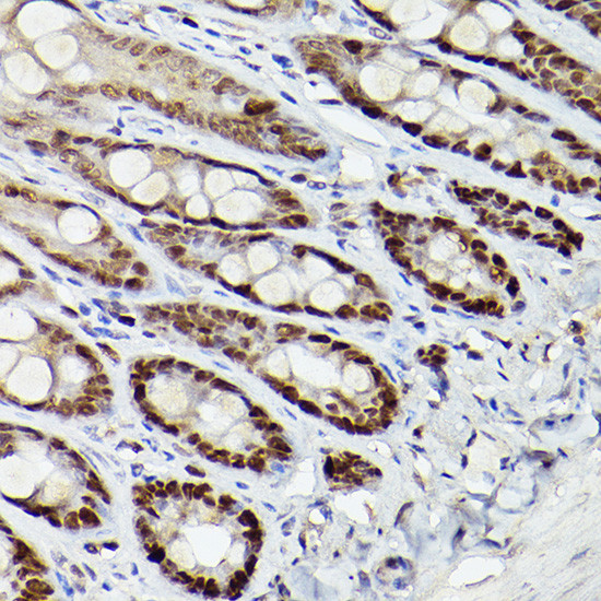 HDAC9 Antibody in Immunohistochemistry (Paraffin) (IHC (P))