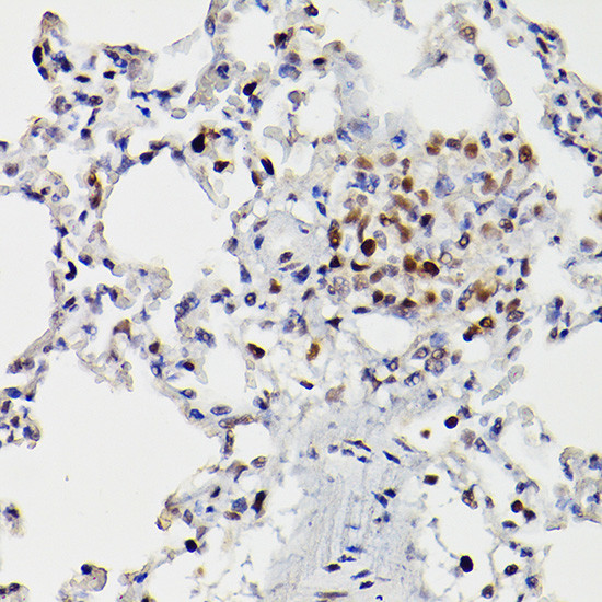 HDAC9 Antibody in Immunohistochemistry (Paraffin) (IHC (P))