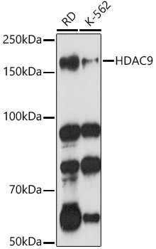 HDAC9 Antibody in Western Blot (WB)