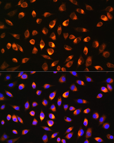 NQO1 Antibody in Immunocytochemistry (ICC/IF)