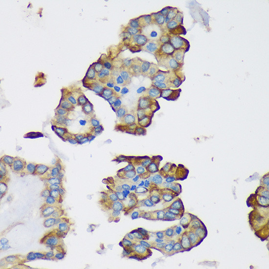 DYNLRB1 Antibody in Immunohistochemistry (Paraffin) (IHC (P))