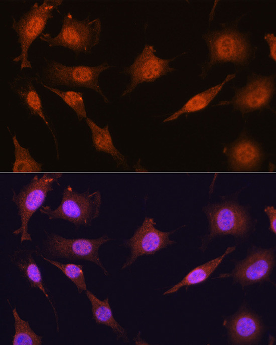 PRMT5 Antibody in Immunocytochemistry (ICC/IF)