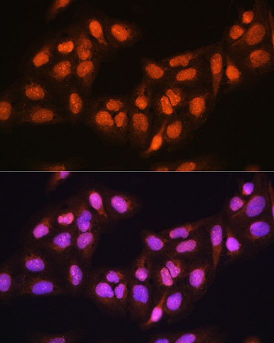 PRMT5 Antibody in Immunocytochemistry (ICC/IF)