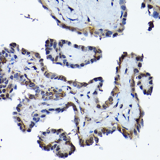 PRMT5 Antibody in Immunohistochemistry (Paraffin) (IHC (P))