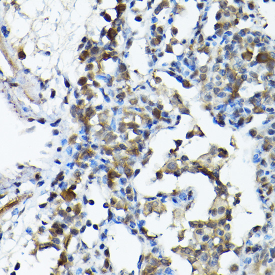 PRMT5 Antibody in Immunohistochemistry (Paraffin) (IHC (P))