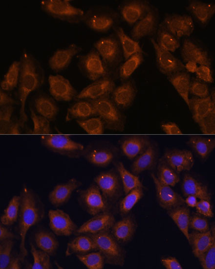 UPF1 Antibody in Immunocytochemistry (ICC/IF)