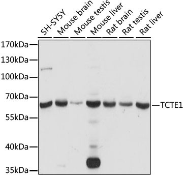 TCTE1 Antibody in Western Blot (WB)