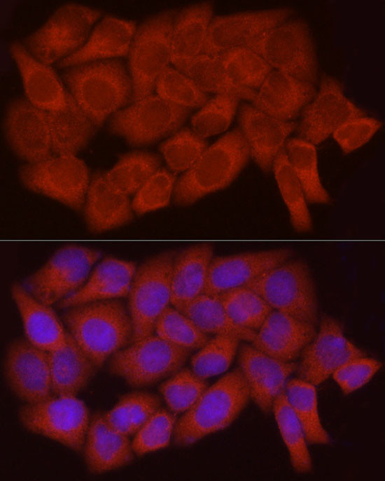 Caspase 7 p11 Antibody in Immunocytochemistry (ICC/IF)