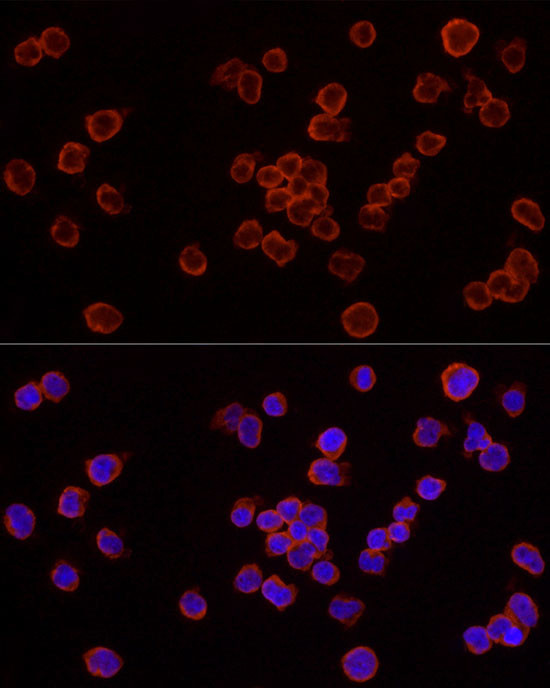 Caspase 7 p11 Antibody in Immunocytochemistry (ICC/IF)