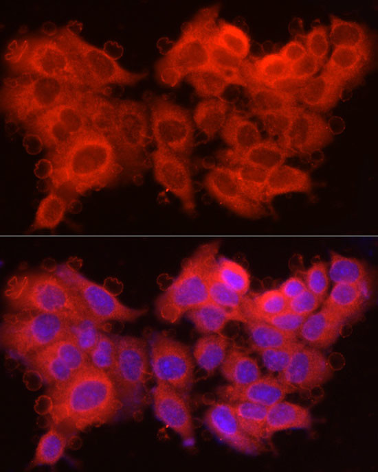 Caspase 7 p11 Antibody in Immunocytochemistry (ICC/IF)