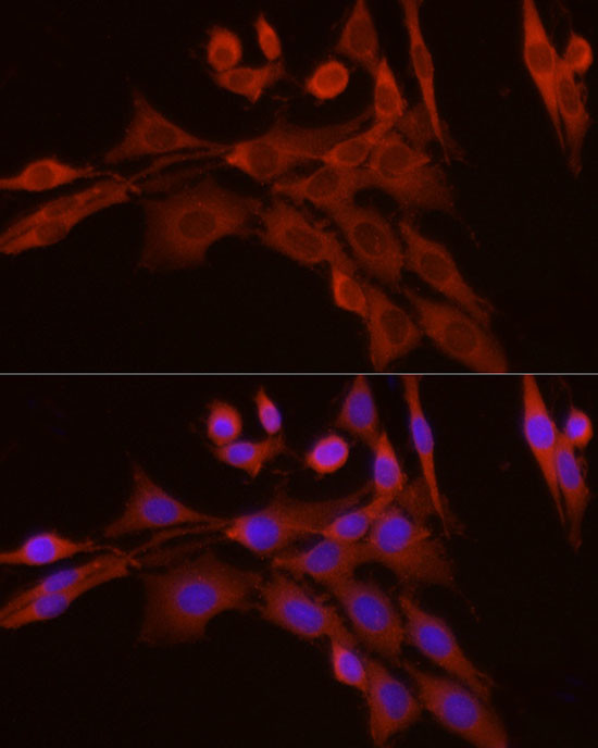 Caspase 7 p11 Antibody in Immunocytochemistry (ICC/IF)