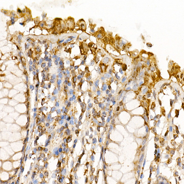 Caspase 7 p11 Antibody in Immunohistochemistry (Paraffin) (IHC (P))