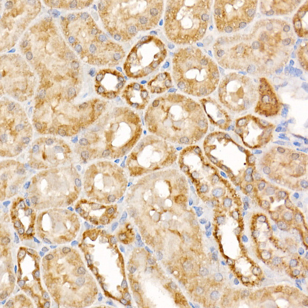 Caspase 7 p11 Antibody in Immunohistochemistry (Paraffin) (IHC (P))