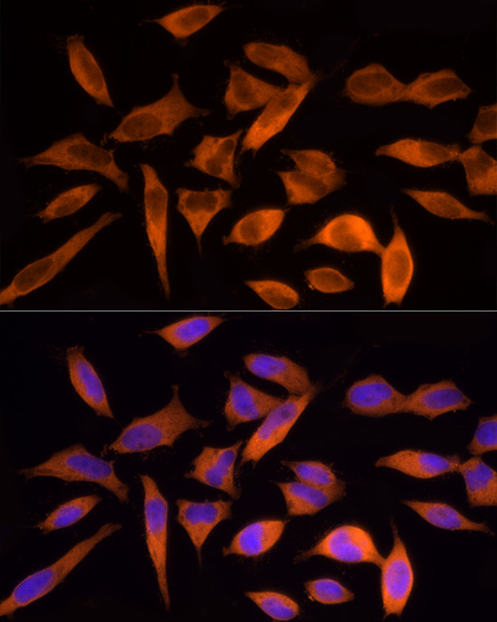 ATP Citrate Lyase Antibody in Immunocytochemistry (ICC/IF)