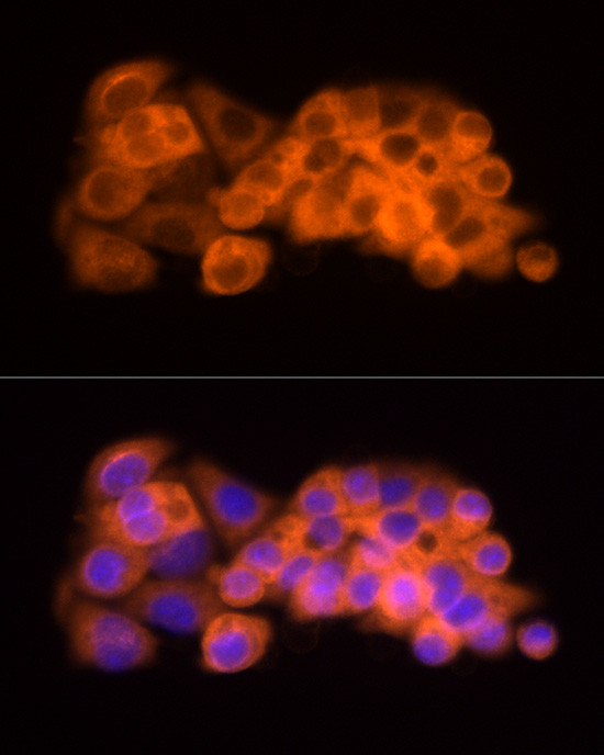 ATP Citrate Lyase Antibody in Immunocytochemistry (ICC/IF)