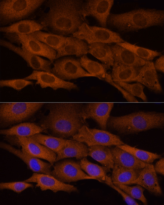 ATP Citrate Lyase Antibody in Immunocytochemistry (ICC/IF)