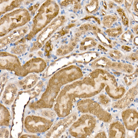 ATP Citrate Lyase Antibody in Immunohistochemistry (Paraffin) (IHC (P))