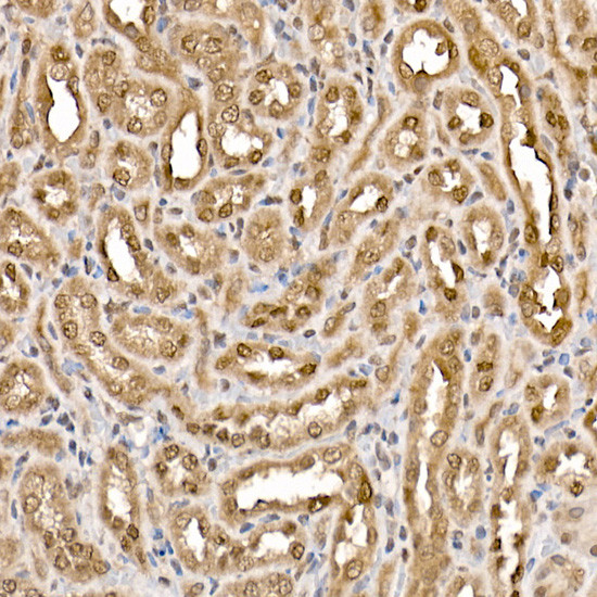 ATP Citrate Lyase Antibody in Immunohistochemistry (Paraffin) (IHC (P))