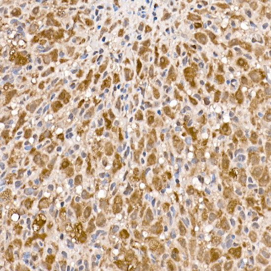 ATP Citrate Lyase Antibody in Immunohistochemistry (Paraffin) (IHC (P))