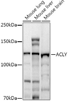 ATP Citrate Lyase Antibody in Western Blot (WB)