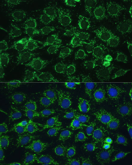 ATP Synthase gamma Antibody in Immunocytochemistry (ICC/IF)