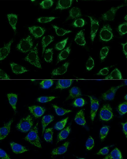 ATP Synthase gamma Antibody in Immunocytochemistry (ICC/IF)