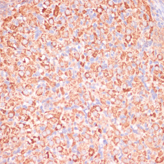 ATP Synthase gamma Antibody in Immunohistochemistry (Paraffin) (IHC (P))