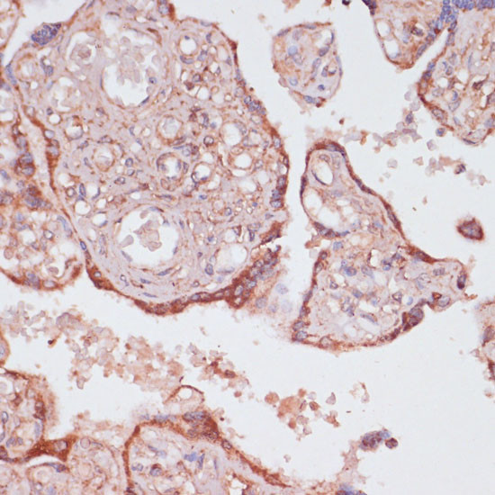 ATP Synthase gamma Antibody in Immunohistochemistry (Paraffin) (IHC (P))