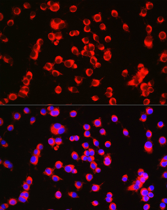 Catenin alpha-1 Antibody in Immunocytochemistry (ICC/IF)