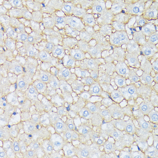 Catenin alpha-1 Antibody in Immunohistochemistry (Paraffin) (IHC (P))