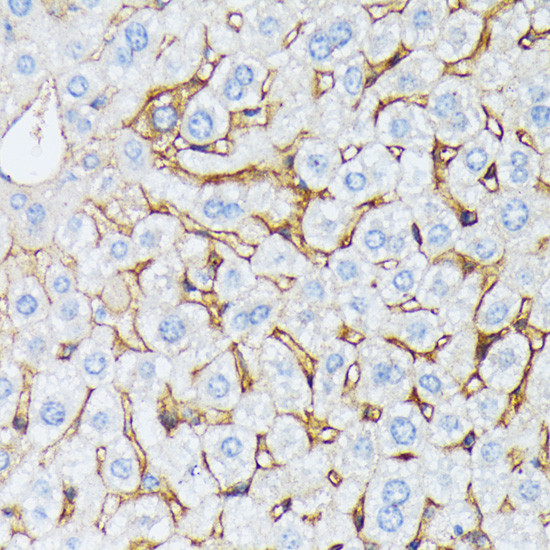 Catenin alpha-1 Antibody in Immunohistochemistry (Paraffin) (IHC (P))