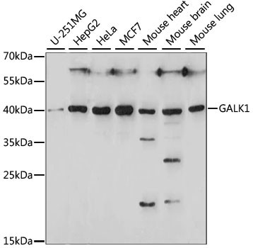 GALK1 Antibody in Western Blot (WB)