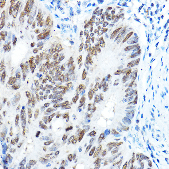 FOXA1 Antibody in Immunohistochemistry (Paraffin) (IHC (P))