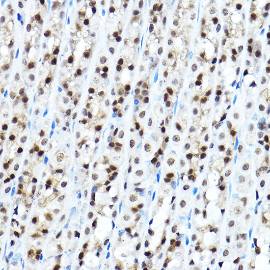 FOXA1 Antibody in Immunohistochemistry (Paraffin) (IHC (P))