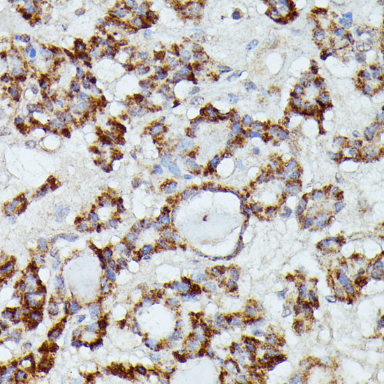 MANBA Antibody in Immunohistochemistry (Paraffin) (IHC (P))