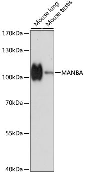 MANBA Antibody in Western Blot (WB)