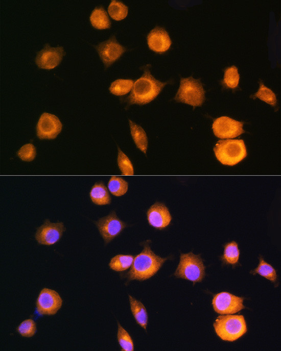 PRKAR2A Antibody in Immunocytochemistry (ICC/IF)