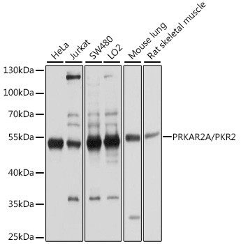 PRKAR2A Antibody in Western Blot (WB)