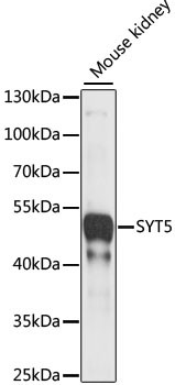 Synaptotagmin 5 Antibody in Western Blot (WB)