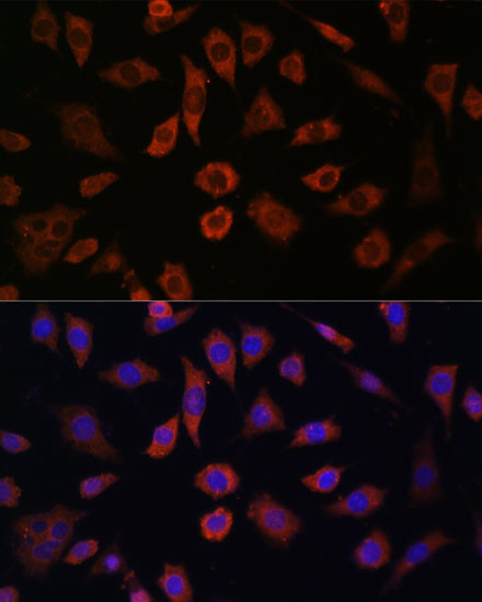 Cytohesin 1 Antibody in Immunocytochemistry (ICC/IF)